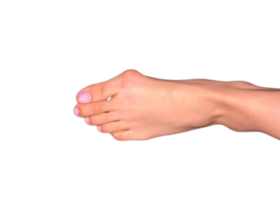 Orthopedic Foot Issues