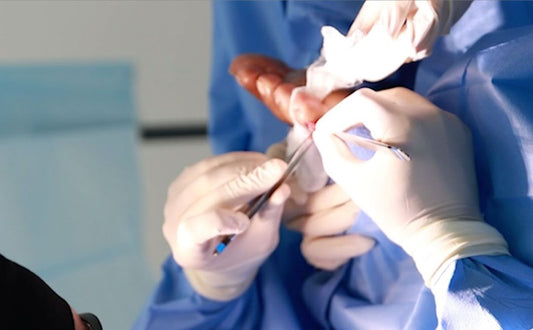 Gynecological Foot Issues