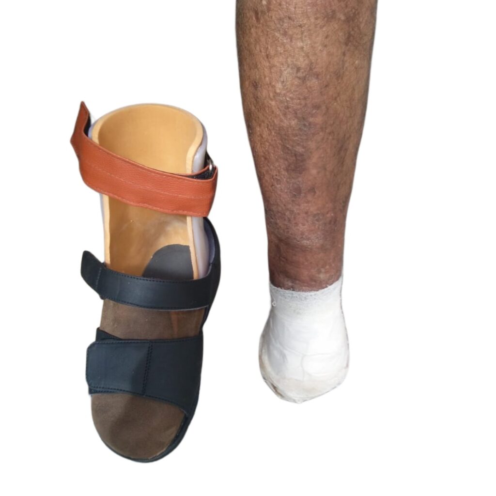stump shoe 1